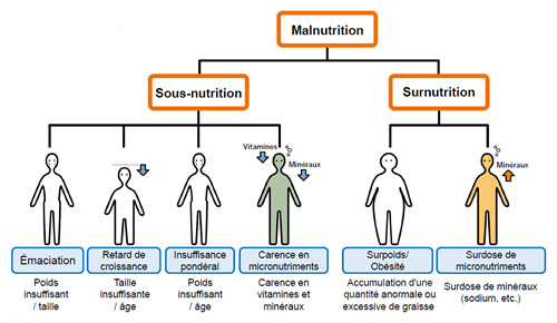Classification de la malnutrition