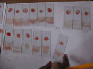 集団血液検査にて集められた血液標本